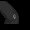 SPORK, NICO - 22.03.1976 - 02.08.2022 - CT obere Extremität - 18:01:46